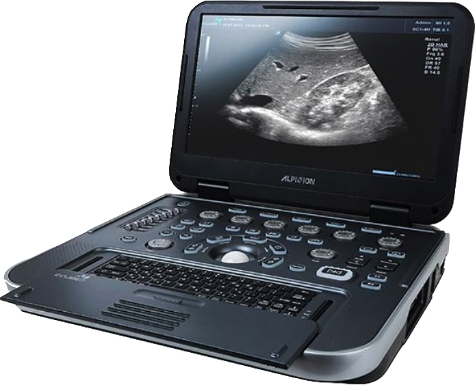 Аппарат УЗИ Alpinion E-cube i7