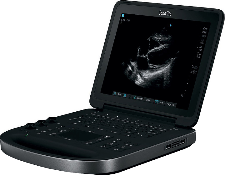 Аппарат УЗИ Fujifilm Sonosite Edge II