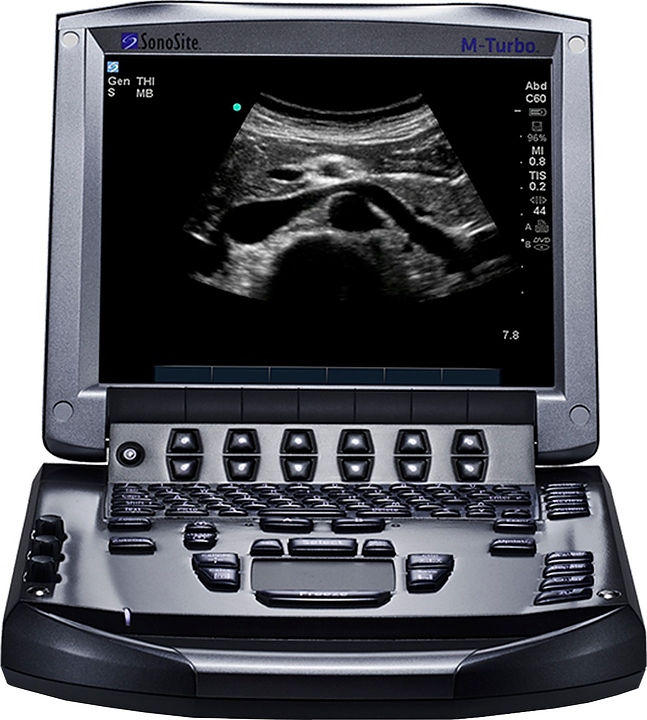 Аппарат УЗИ Fujifilm Sonosite M-turbo