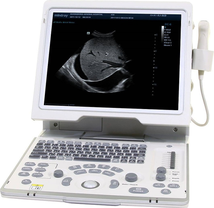 Аппарат УЗИ Mindray DP-50