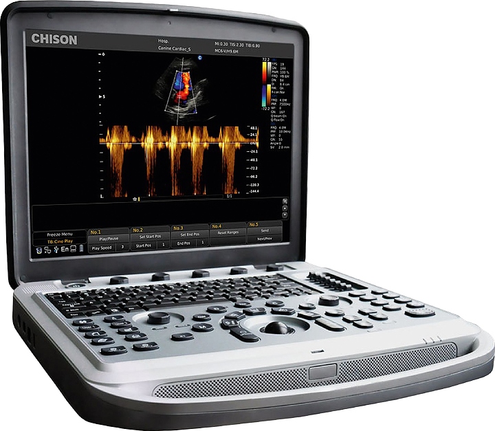 Аппарат УЗИ Chison SonoTouch 80 Pro