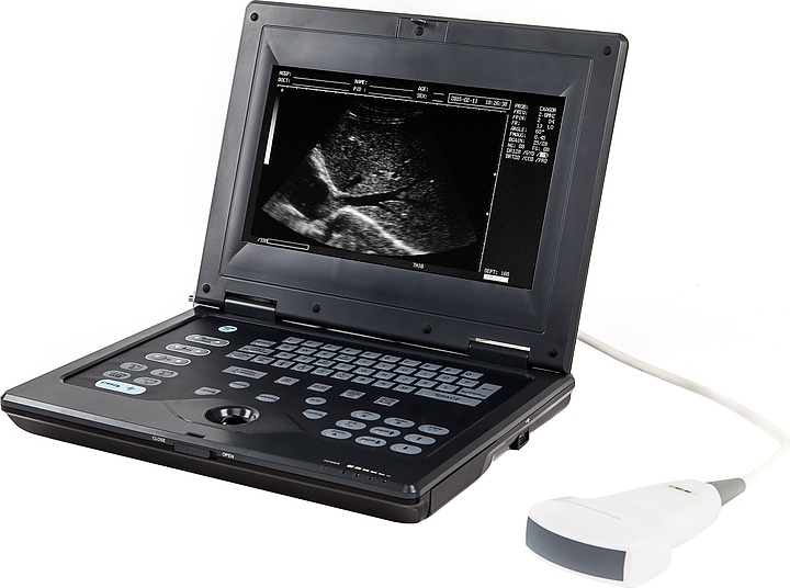 Аппарат УЗИ AcuVista RS880c