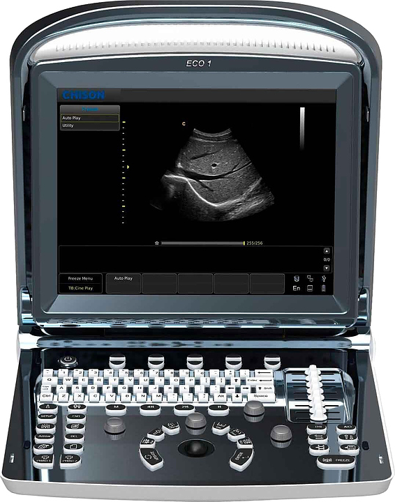 Аппарат УЗИ Chison SonoTouch 10