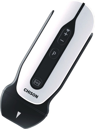 Аппарат УЗИ Chison SonoEye