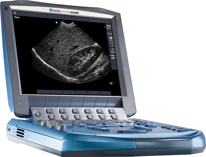 Аппарат УЗИ Fujifilm Sonosite MicroMaxx