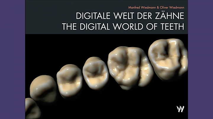 Модуль для программного обеспечения Exocad Trusmile