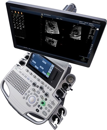 Аппарат УЗИ GE Healthcare LOGIQ S7 XDclear