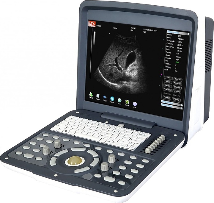Аппарат УЗИ AcuVista RS880d