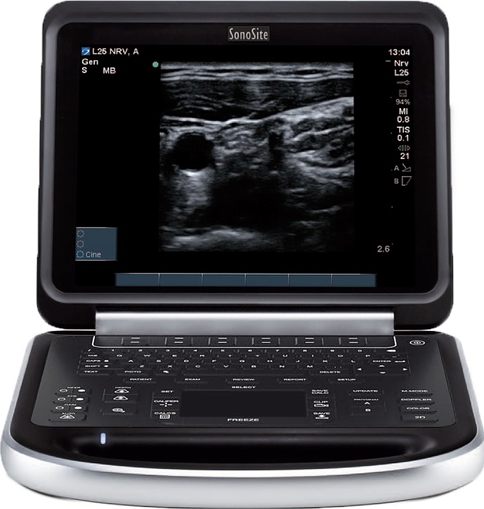 Аппарат УЗИ Fujifilm Sonosite Edge