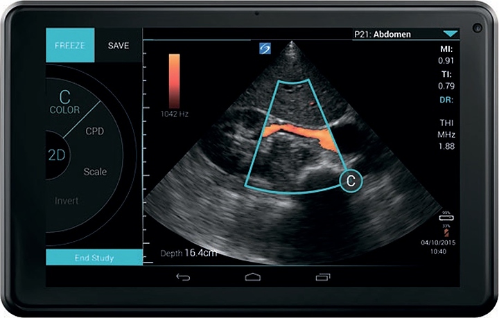 Аппарат УЗИ Fujifilm Sonosite iViz