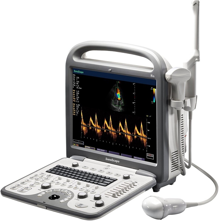 Аппарат УЗИ SonoScape S8