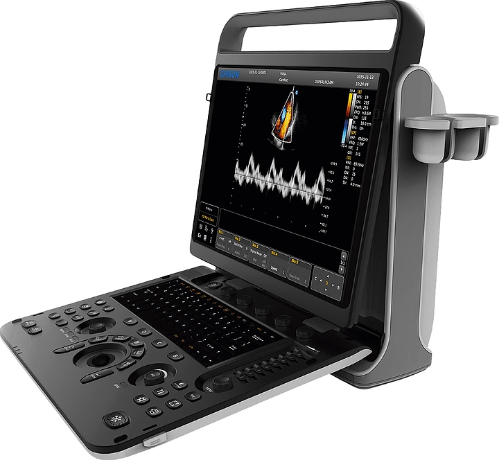 Аппарат УЗИ Chison SonoTouch 60 Pro