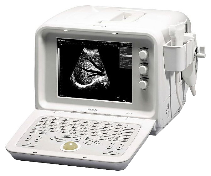 Аппарат УЗИ Edan Dus 3