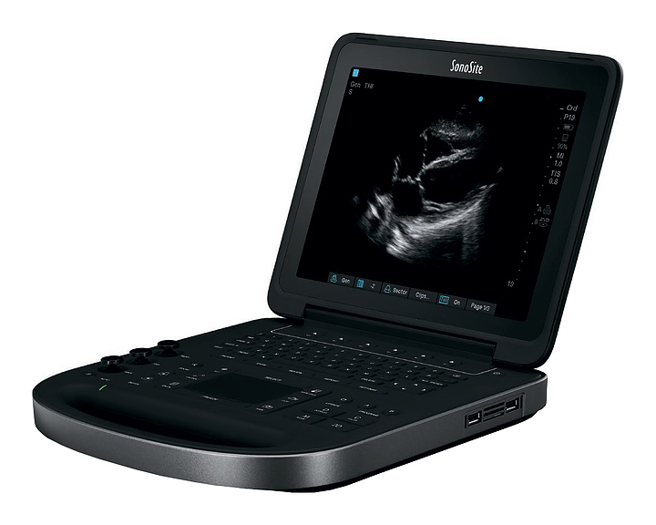 Аппарат УЗИ Fujifilm Sonosite Edge II