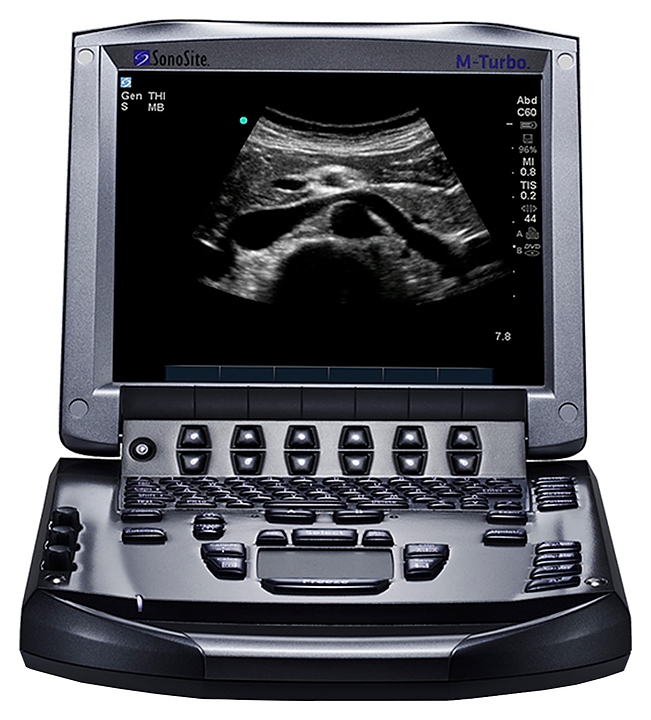 Аппарат УЗИ Fujifilm Sonosite M-turbo