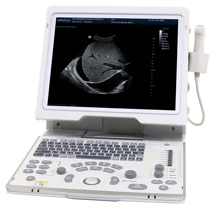Аппарат УЗИ Mindray DP-50