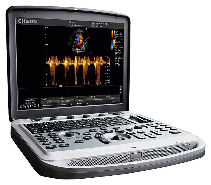 Аппарат УЗИ Chison SonoTouch 80 Pro