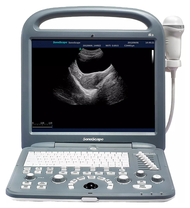 Аппарат УЗИ SonoScape S2