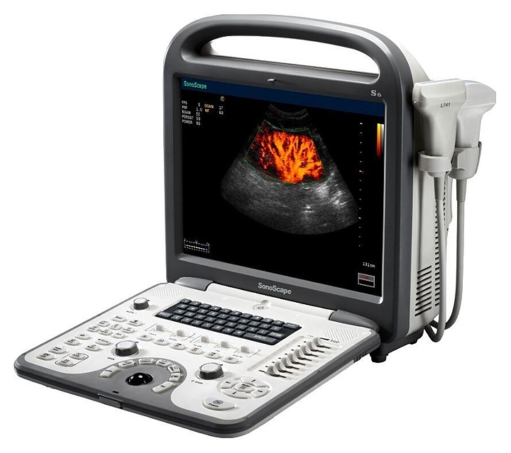 Аппарат УЗИ SonoScape S6 Pro