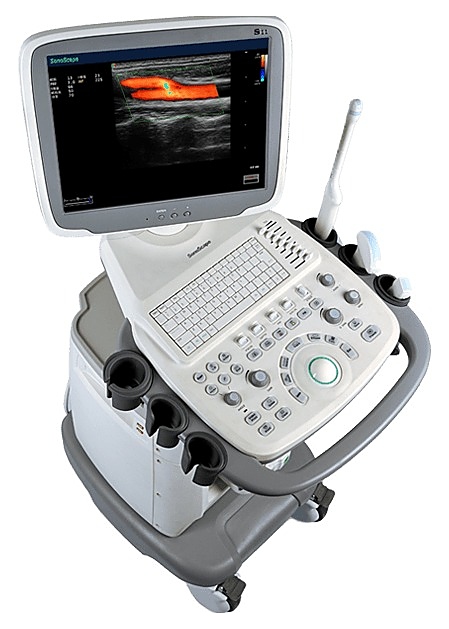 Аппарат УЗИ SonoScape S11