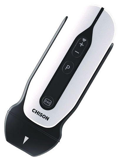 Аппарат УЗИ Chison SonoEye