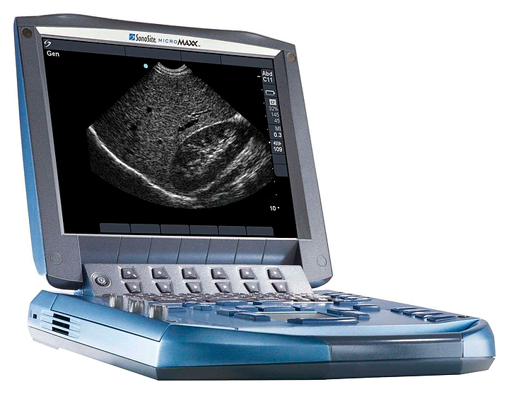 Аппарат УЗИ Fujifilm Sonosite MicroMaxx