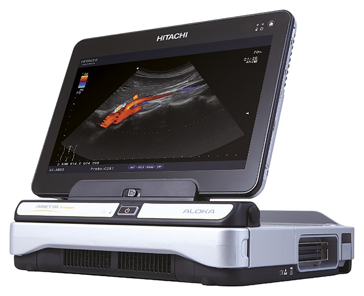 Аппарат УЗИ Hitachi Arietta prologue