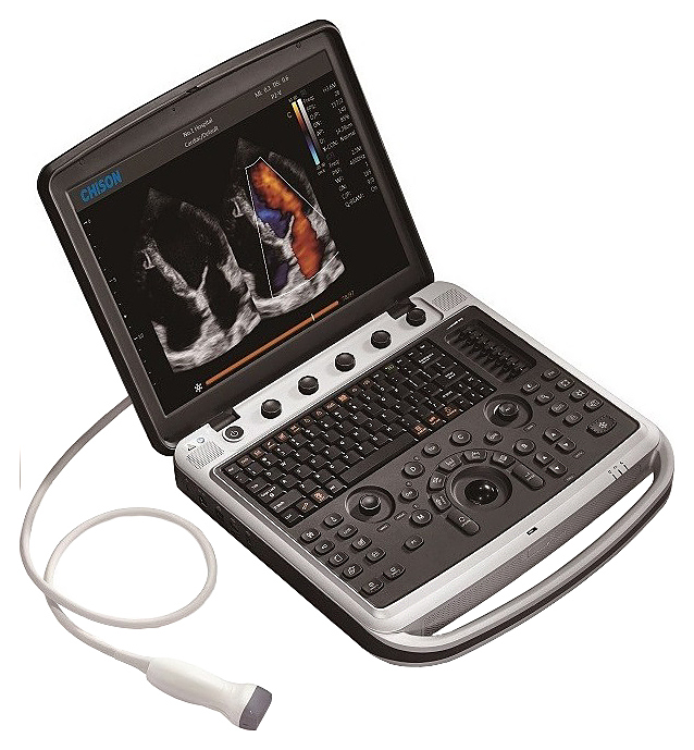 Аппарат УЗИ Chison SonoTouch 80 Expert