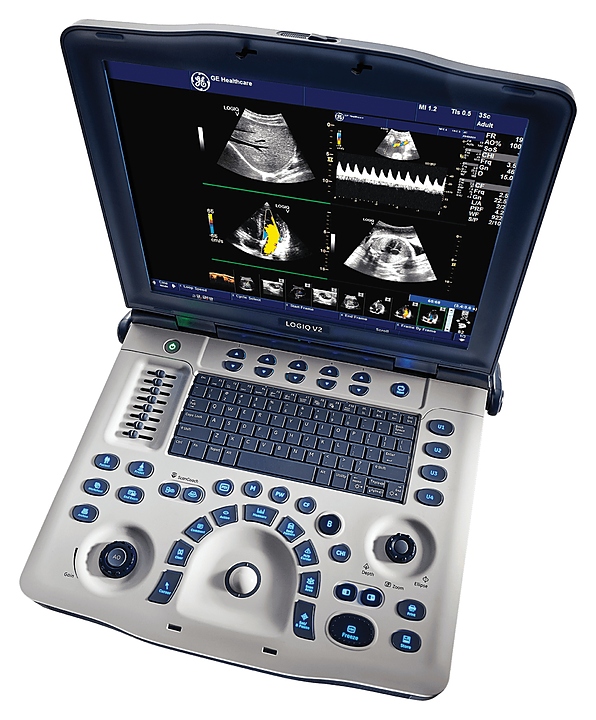Аппарат УЗИ GE Healthcare LOGIQ V2