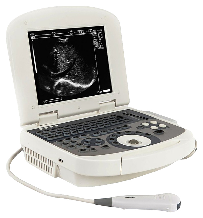 Аппарат УЗИ ветеринарный AcuVista VT98c