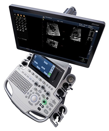 Аппарат УЗИ GE Healthcare LOGIQ S7 XDclear