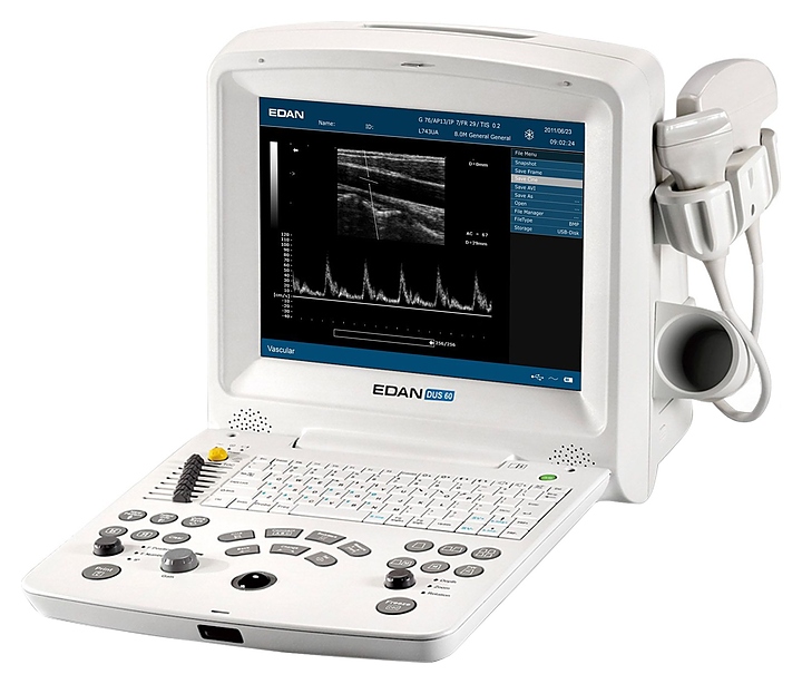 Аппарат УЗИ Edan Dus 60