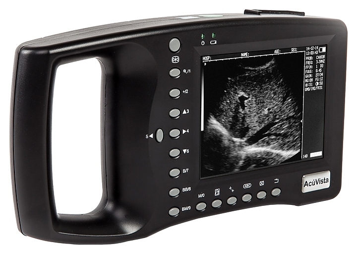 Аппарат УЗИ AcuVista RS880b