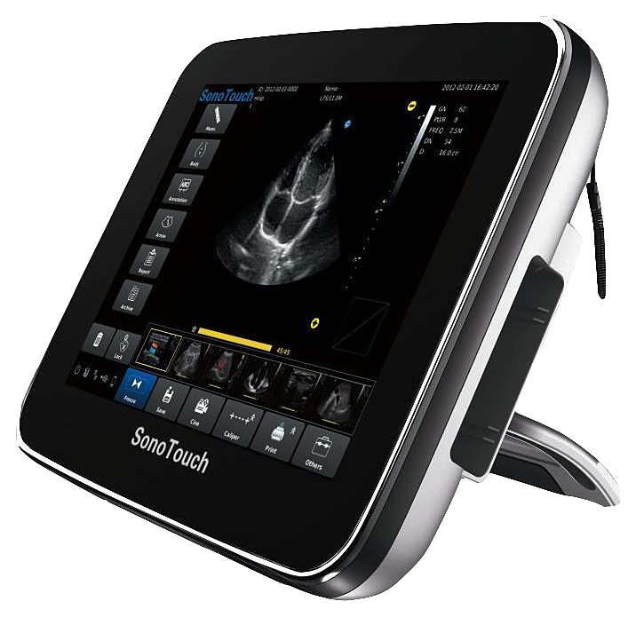 Аппарат УЗИ Chison SonoTouch 30
