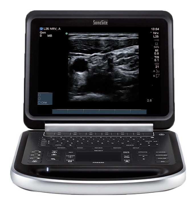 Аппарат УЗИ Fujifilm Sonosite Edge
