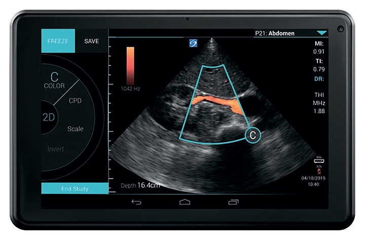 Аппарат УЗИ Fujifilm Sonosite iViz