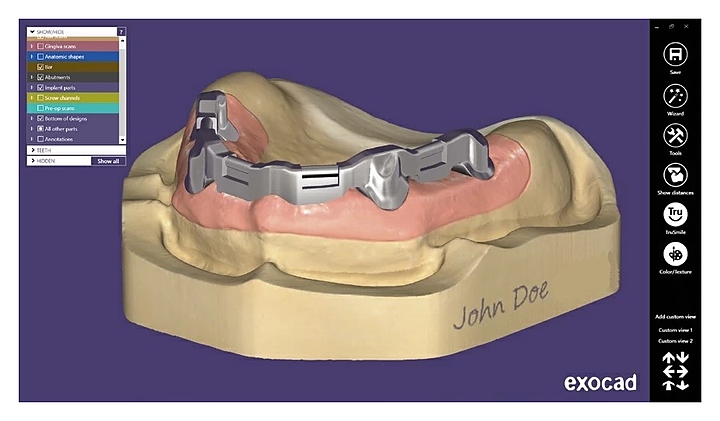 Модуль для программного обеспечения Exocad Full Denture Module