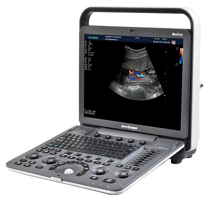 Аппарат УЗИ SonoScape S8 Exp
