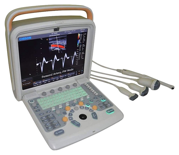 Аппарат УЗИ Chison q5